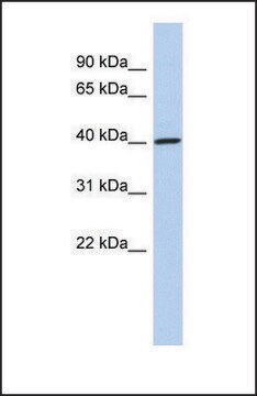 Anti-DDI1 antibody produced in rabbit affinity isolated antibody