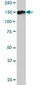 Monoclonal Anti-DDEF1 antibody produced in mouse clone 2G7, purified immunoglobulin, buffered aqueous solution