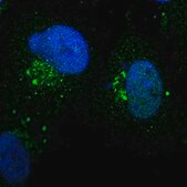 Anti-ZNF75D antibody produced in rabbit Prestige Antibodies&#174; Powered by Atlas Antibodies, affinity isolated antibody, buffered aqueous glycerol solution