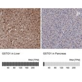 Anti-GSTO1 antibody produced in rabbit Prestige Antibodies® Powered by Atlas Antibodies, affinity isolated antibody, buffered aqueous glycerol solution