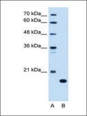 Anti-C8B (AB2) antibody produced in rabbit affinity isolated antibody