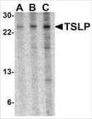 抗-TSLP (ab3) 兔抗 affinity isolated antibody