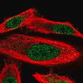 Anti-WDR25 antibody produced in rabbit Prestige Antibodies&#174; Powered by Atlas Antibodies, affinity isolated antibody, buffered aqueous glycerol solution