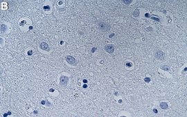 Anti-PHF20 Antibody, clone 1N6 ZooMAb&#174; Rabbit Monoclonal recombinant, expressed in HEK 293 cells