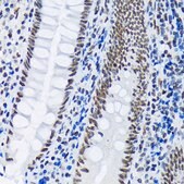 Anti-PIAS1+PIAS2 Antibody, clone 8P1D2, Rabbit Monoclonal