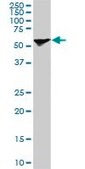 Monoclonal Anti-STIP1, (C-terminal) antibody produced in mouse clone 1E3, purified immunoglobulin, buffered aqueous solution