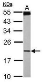 Anti-PDCD6 antibody produced in rabbit affinity isolated antibody, buffered aqueous solution