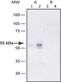 Anti-RALT/MIG-6 (PE-16) antibody produced in rabbit affinity isolated antibody, buffered aqueous solution