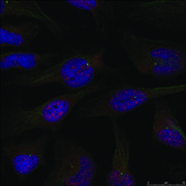 Anti-RELA (Ab-276) antibody produced in rabbit affinity isolated antibody