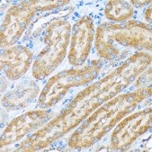 Anti-COPA antibody produced in rabbit