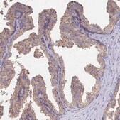 Anti-CLTC antibody produced in rabbit Prestige Antibodies&#174; Powered by Atlas Antibodies, affinity isolated antibody, buffered aqueous glycerol solution