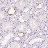 Anti-AQP2 antibody produced in rabbit Prestige Antibodies&#174; Powered by Atlas Antibodies, affinity isolated antibody, buffered aqueous glycerol solution