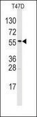 Anti-SNX6 (center) antibody produced in rabbit Ig fraction of antiserum, buffered aqueous solution