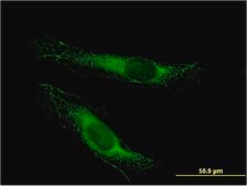 Monoclonal Anti-LSS, (C-terminal) antibody produced in mouse clone 2E4, purified immunoglobulin, buffered aqueous solution