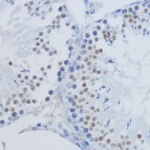 Anti-TriMethyl-Histone H3-K36 antibody produced in rabbit