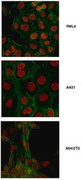 Anti-SMARCA5 Antibody from rabbit, purified by affinity chromatography