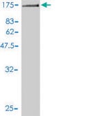 Monoclonal Anti-GTF3C2 antibody produced in mouse clone 1C6-2B8, purified immunoglobulin, buffered aqueous solution