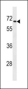 ANTI-UGT2B28 (CENTER) antibody produced in rabbit affinity isolated antibody, buffered aqueous solution