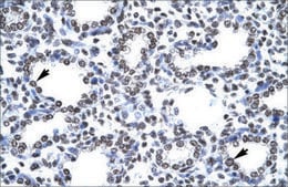 Anti-CITED1 antibody produced in rabbit affinity isolated antibody