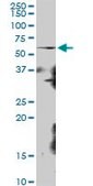 Anti-KIAA0409 antibody produced in mouse purified immunoglobulin, buffered aqueous solution