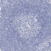 Anti-PLLP antibody produced in rabbit Prestige Antibodies&#174; Powered by Atlas Antibodies, affinity isolated antibody, buffered aqueous glycerol solution