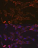 Anti-Inhibin beta A (INHBA) Antibody, clone 1X6N9, Rabbit Monoclonal