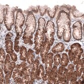 Anti-ACSL3 antibody produced in rabbit Prestige Antibodies&#174; Powered by Atlas Antibodies, affinity isolated antibody, buffered aqueous glycerol solution