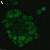Anti-GLS2 Antibody, clone 3G12 ZooMAb® Rabbit Monoclonal recombinant, expressed in HEK 293 cells
