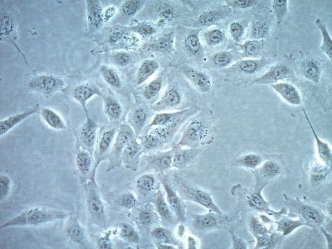 TPC-1 Human Papillary Thyroid Carcinoma Cell line TPC-1 human papillary thyroid carcinoma cell line is a highly characterized model for thyroid cancer research.