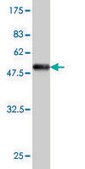 Monoclonal Anti-VSNL1 antibody produced in mouse clone 2F1-E3, purified immunoglobulin, buffered aqueous solution