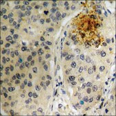 Anti-phospho-Tau (pThr205) antibody produced in rabbit affinity isolated antibody
