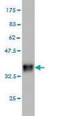 Monoclonal Anti-CTNS antibody produced in mouse clone 5G6, purified immunoglobulin, buffered aqueous solution