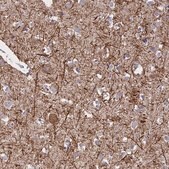 Anti-ENPP6 antibody produced in rabbit Prestige Antibodies&#174; Powered by Atlas Antibodies, affinity isolated antibody, buffered aqueous glycerol solution