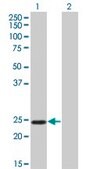 Monoclonal Anti-TWIST1 antibody produced in mouse clone 3E11, purified immunoglobulin, buffered aqueous solution