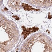 Anti-PROKR2 antibody produced in rabbit Prestige Antibodies&#174; Powered by Atlas Antibodies, affinity isolated antibody, buffered aqueous glycerol solution