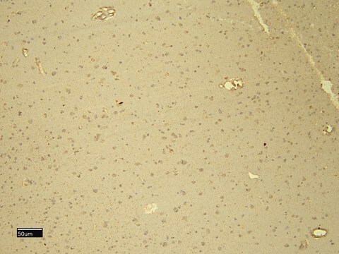 Anti-DDB1 antibody produced in goat affinity isolated antibody, buffered aqueous solution
