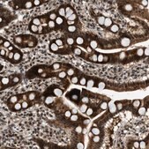 Anti-WRB antibody produced in rabbit Prestige Antibodies&#174; Powered by Atlas Antibodies, affinity isolated antibody, buffered aqueous glycerol solution