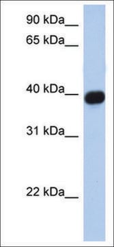 Anti-CXCR6 antibody produced in rabbit affinity isolated antibody