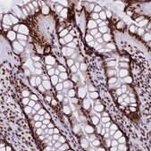 Anti-CPSF7 antibody produced in rabbit affinity isolated antibody, buffered aqueous glycerol solution