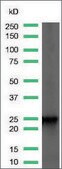 Anti-Lambda Light Chain antibody, Rabbit monoclonal recombinant, expressed in proprietary host, clone SP147, affinity isolated antibody