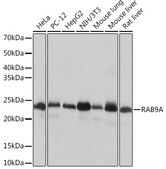 Anti-RAB9A Antibody, clone 7O1G4, Rabbit Monoclonal