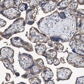 Anti-UPF1 antibody produced in rabbit Prestige Antibodies&#174; Powered by Atlas Antibodies, affinity isolated antibody, buffered aqueous glycerol solution, Ab2