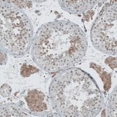 Anti-CERS3 antibody produced in rabbit Prestige Antibodies® Powered by Atlas Antibodies, affinity isolated antibody, buffered aqueous glycerol solution