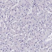 Anti-SEPT1 antibody produced in rabbit Prestige Antibodies&#174; Powered by Atlas Antibodies, affinity isolated antibody, buffered aqueous glycerol solution