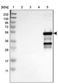 Anti-CYP2C9 antibody produced in rabbit Prestige Antibodies&#174; Powered by Atlas Antibodies, affinity isolated antibody, buffered aqueous glycerol solution