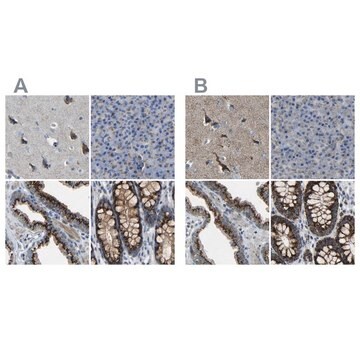 Anti-CANT1 antibody produced in rabbit Prestige Antibodies&#174; Powered by Atlas Antibodies, affinity isolated antibody, buffered aqueous glycerol solution, Ab2