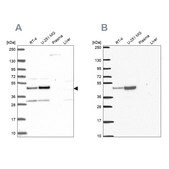 Anti-RRS1 antibody produced in rabbit Prestige Antibodies® Powered by Atlas Antibodies, affinity isolated antibody, buffered aqueous glycerol solution
