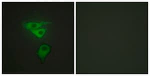 Anti-PDLIM1 antibody produced in rabbit affinity isolated antibody