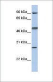 Anti-CENPI antibody produced in rabbit affinity isolated antibody