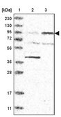 Anti-ITGB8 antibody produced in rabbit Prestige Antibodies® Powered by Atlas Antibodies, affinity isolated antibody, buffered aqueous glycerol solution, ab1